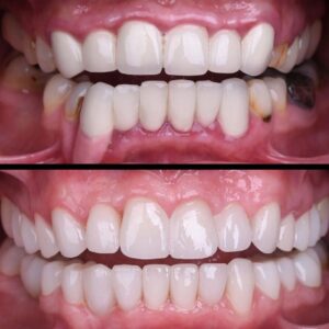 WhatsApp Image 2024-11-26 à 12.57.09 (1)